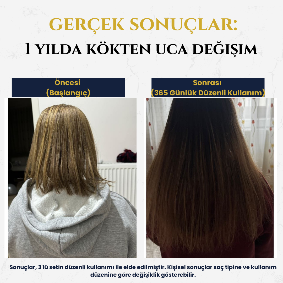 İlikli Güç 3'lü Set