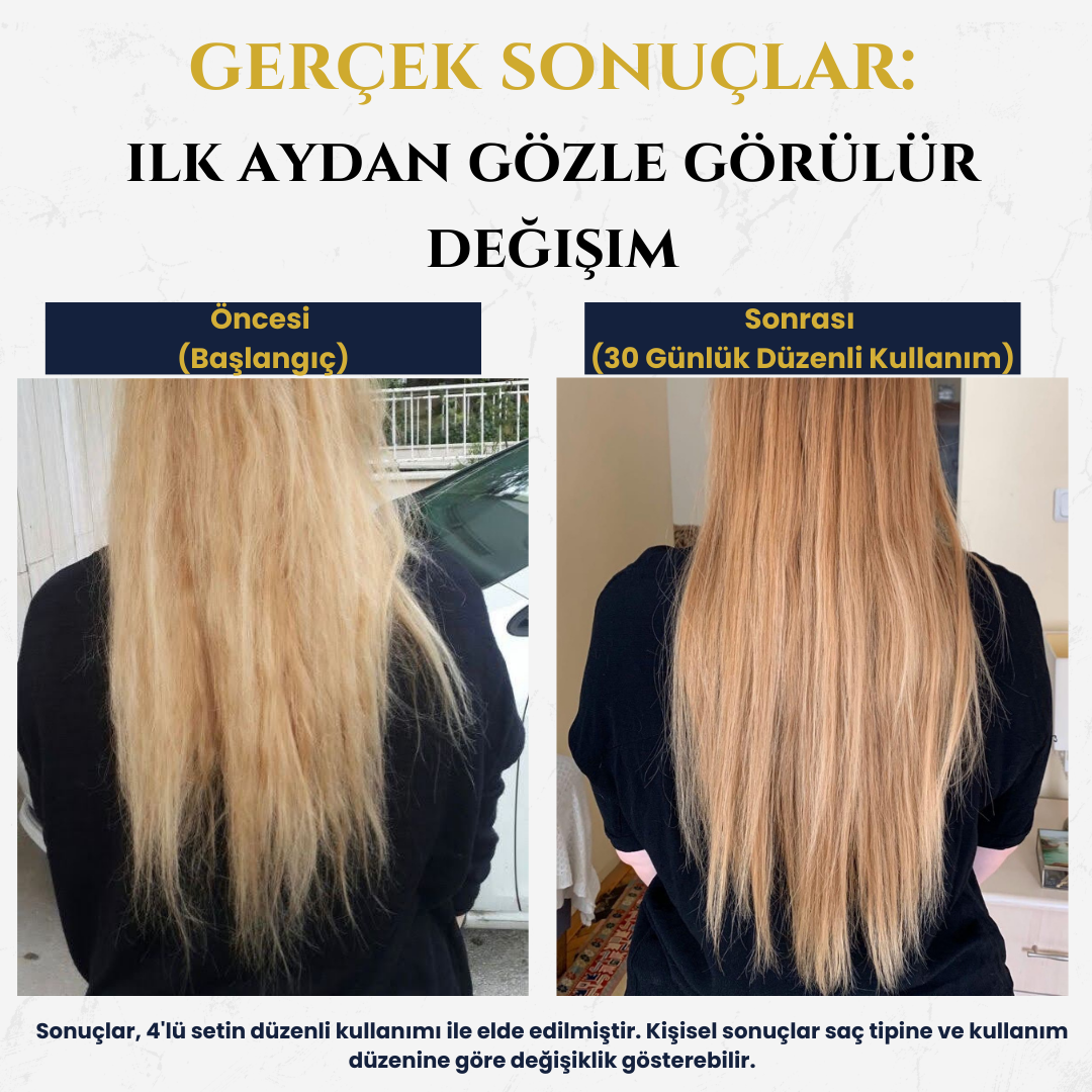 All-in One X Komple Saç Bakım Seti