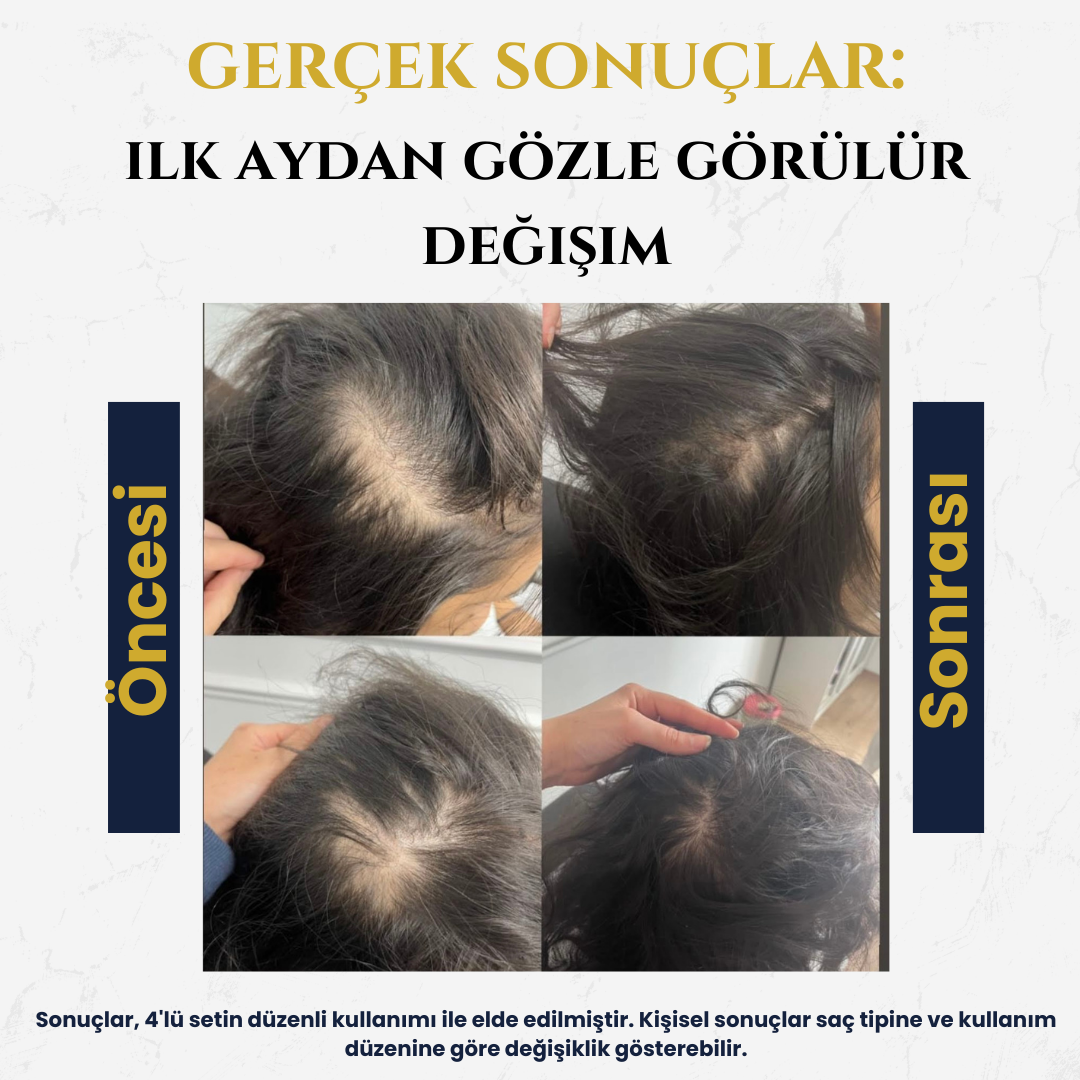 All-in One X Komple Saç Bakım Seti