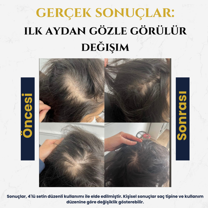 All-in One X Komple Saç Bakım Seti